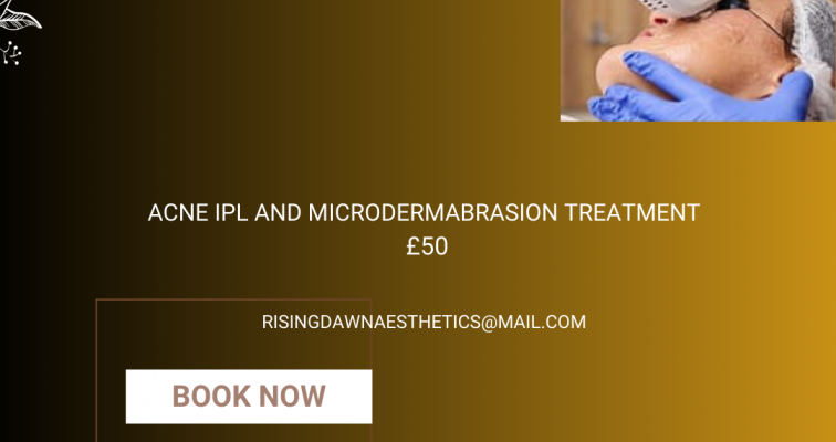 Photo of ACNE IPL AND MICRODERMABRASION TREATMENT