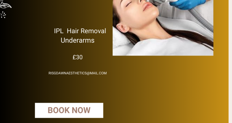 Photo of Hair removal Intense Pulsed Light (IPL) Underarms