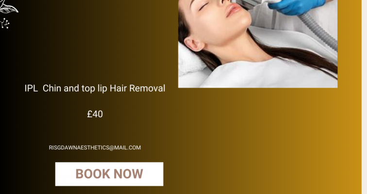 Photo of Hair removal Intense Pulsed Light (IPL) Chin and top lip