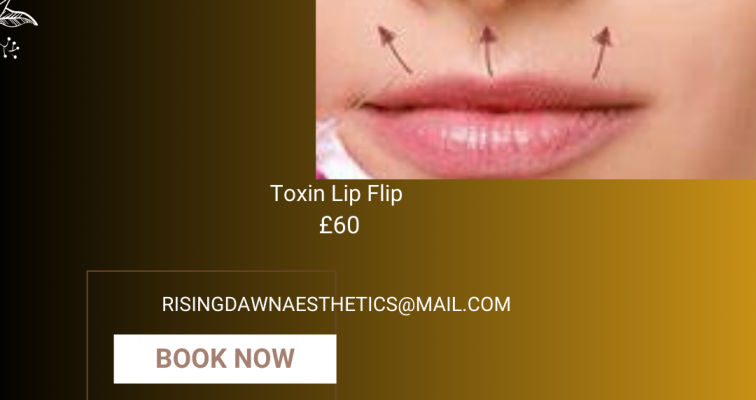 Photo of Toxin Lip Flip